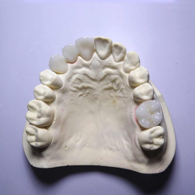 Zirconia အလွှာ