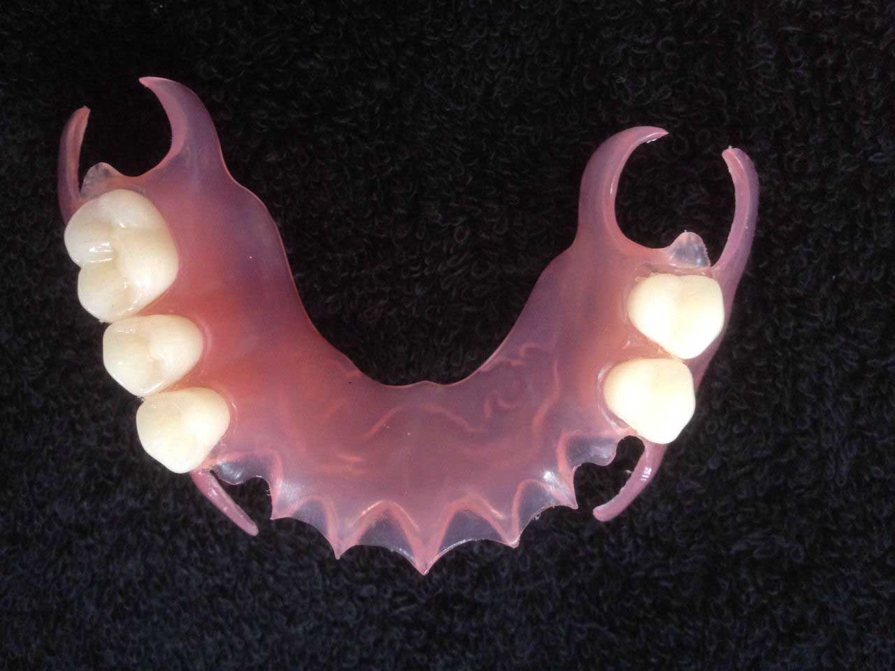 Partial Denture သွားဘက်ဆိုင်ရာ Acrylic သွားများအတွက် သွားဘက်ဆိုင်ရာ လွယ်ကူမြန်ဆန်စွာ