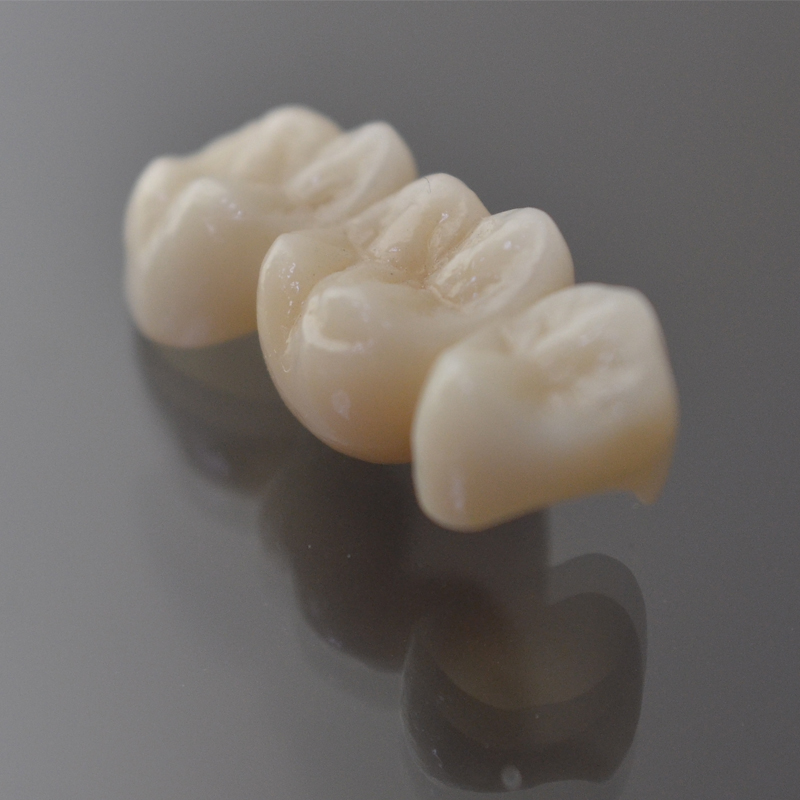 Zirconia Crown ၏အင်္ဂါရပ်များ