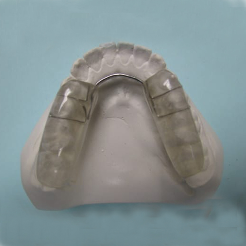 တည်ငြိမ်သော occlusal splint ၏နိဒါန်းနှင့်ညွှန်ပြချက်များ