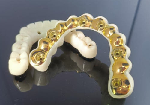 CAD/CAM တိုက်တေနီယမ် အစားထိုး ဘား + ဇာကိုနီးယား တံတား