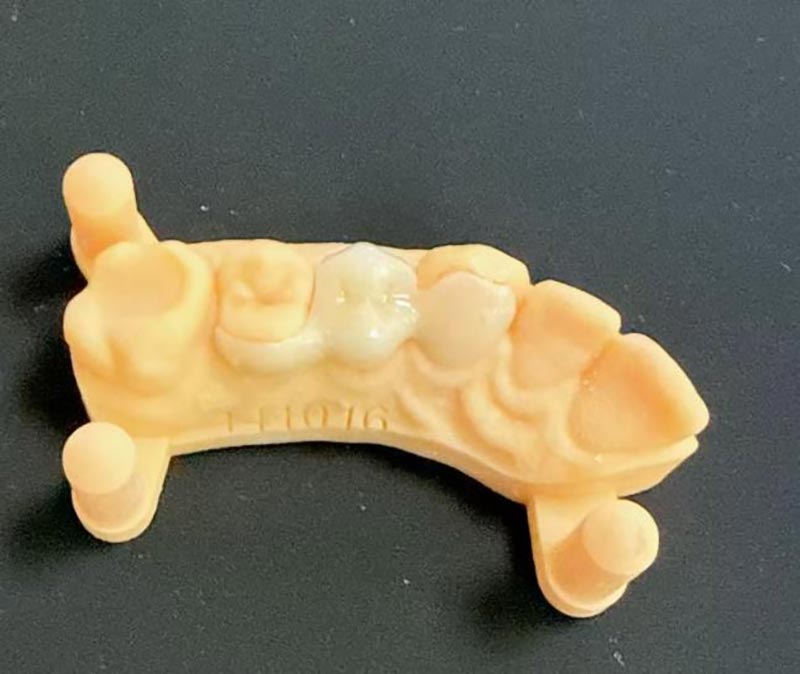 Maryland တံတားများအကြောင်း သင်သိလိုသည်များ