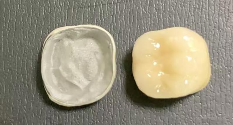 WM DENTAL LAB - ထိပ်တန်းတရုတ်သွားဘက်ဆိုင်ရာဓာတ်ခွဲခန်း