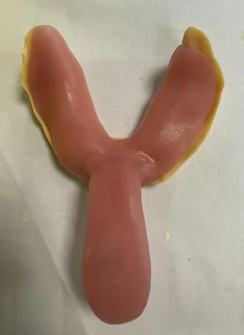 စိတ်ကြိုက် သွားနှင့်ခံတွင်းဗူးများအကြောင်း သင်မသိခဲ့သော အရာများ