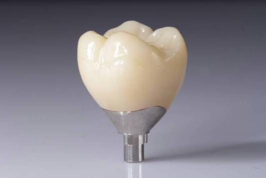Zirconia ပြန်လည်ထူထောင်မှုများ (သရဖူများ၊ တံတားများ၊ အစားထိုးမှုများ) ဖြင့် သင့်ရလဒ်များကို အကောင်းဆုံးဖြစ်အောင်လုပ်ပါ။