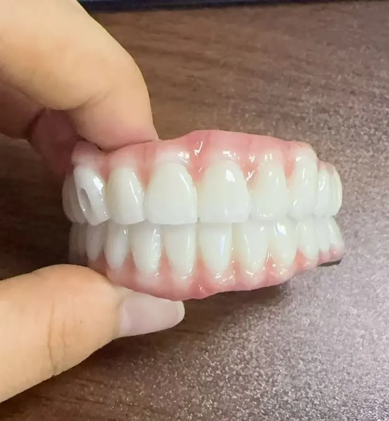 Malocclusion ၏အန္တရာယ်များ