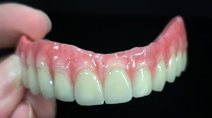 4 မျိုးစပ် - hybrid - Malo Bridge zirconia zirconia အပြည့်အဝ citanium ဖွဲ့စည်းပုံကျော်