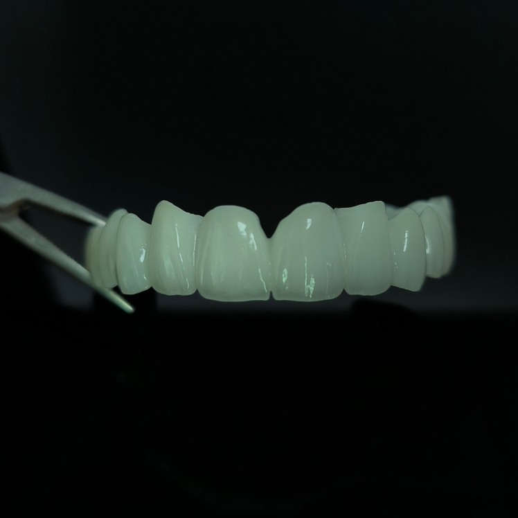 High Translucent Zirconia Bridge Layered Zirconia China သွားဘက်ဆိုင်ရာဓာတ်ခွဲခန်း အလုပ်