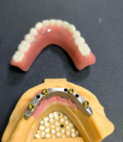 တည်နေရာနှင့် သွားဘက်ဆိုင်ရာဘား